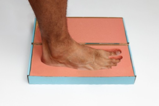 How Custom Orthotics Can Help Arthritis Pain