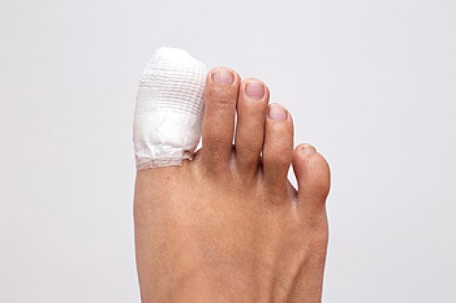 What to Expect With a Broken Toe